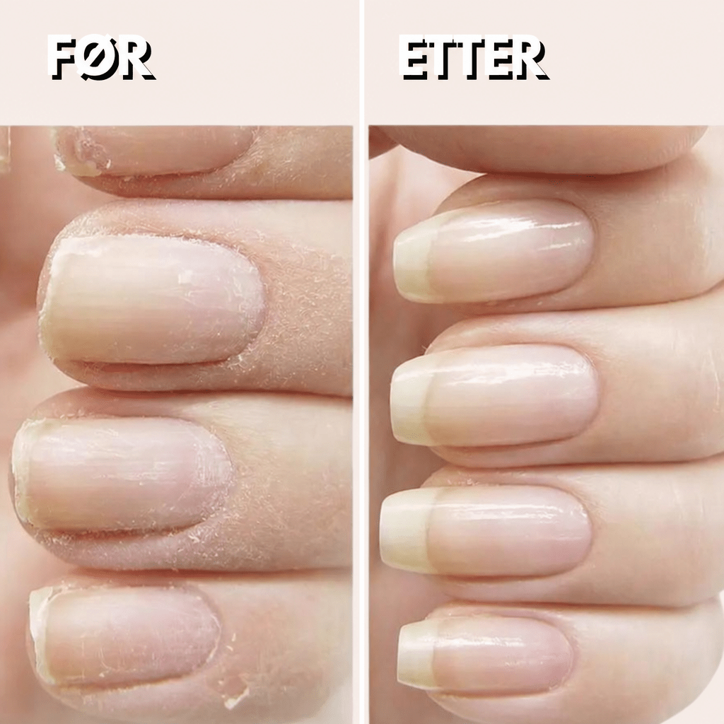 GlamTrim™ Elektrisk negleklipper - Få perfekt pleide negler med sikker og skånsom trimming - AVABeauty.no
